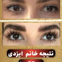 مژه ها و ابروهات رو تقویت کن