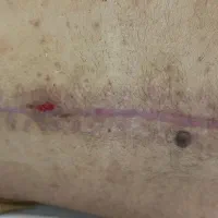 انجام خدمات درمانی،تزریقات و پانسمان نوین در منزل|خدمات زیبایی و سلامت|رشت, گلسار|دیوار