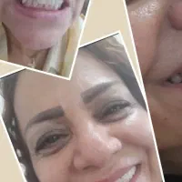 ساخت پروتز مصنوعی|پزشکی|آمل, |دیوار