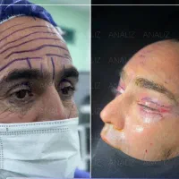 جشنواره عمل بینی ، لیفت شقیقه، اندسکوپیک، مید فیس|خدمات زیبایی و سلامت|شیراز, ستارخان|دیوار