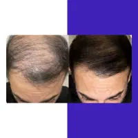 کمکت میکنم از افسردگی در بیای