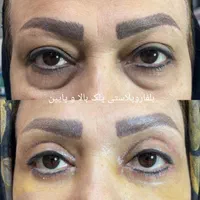 جراحی‌های زیبایی توسط متخصص در بیمارستان قم|خدمات آرایشگری و زیبایی|قم, بلوار امین و ساحلی|دیوار