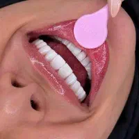 کامپوزیت دندان (لبخندی زیبا)