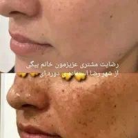 با این کرم فقط با ده روز پوستت رو فوق العاده کن|آرایشی، بهداشتی، درمانی|لردگان, |دیوار