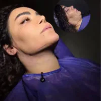 جشنواره ساکشن غبغب وبلفاروتضمینی(۷تومن)کاشت ابرو