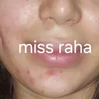 ژل سی سی۴۰۰، پرسینگ، چال گونه|خدمات آرایشگری و زیبایی|اهواز, کمپلو جنوبی|دیوار