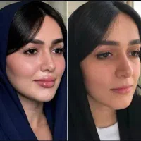 تخفیفات ویژه بوتاکس صورت و فیلر لب،فول فیس و...|خدمات آرایشگری و زیبایی|مشهد, شهید فرامرز عباسی|دیوار