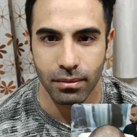 کاشت مو ابرو لیزر ژل بوتاکس مزو واکسن زگیل تناسلی|خدمات آرایشگری و زیبایی|اندیشه, اندیشه فاز ۱|دیوار