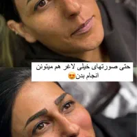 فیلر ژل بوتاکس مزو لیزر هایفو فول فیس ۵۰٪ آف|خدمات آرایشگری و زیبایی|مشهد, فرهنگ|دیوار