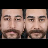 میکروابروی آقایان/ فول نچرال و کاملاً مردانه|خدمات آرایشگری و زیبایی|رشت, قاسمیه|دیوار