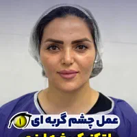 جراحی پلک ،بلفاروپلاستی ،لیفت شقیقه، جراحی زیبایی|خدمات آرایشگری و زیبایی|تهران, امانیه|دیوار