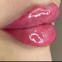 جشنواره تزریق ژل بوتاکس فیلر/لیفت میدفیس/لاغری