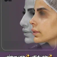 جشنواره جوانسازی Max Lift پزشک پوست مو بینی زیبایی|خدمات آرایشگری و زیبایی|مشهد, هفت تیر (حافظ)|دیوار