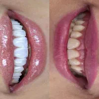 بهترین خدمات دندانپزشکی درمانی و زیبایی