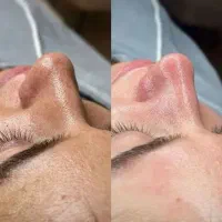 آف ویژه، پاکسازی ،فیشیال و کربوکسی از 350