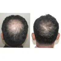 شونه لا موهات میشکنه