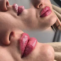 تزریق ژل بوتاکس نخ لیفت فیلر بادی یوسفی مقدم
