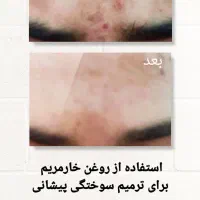 مشاور طب سنتی|خدمات آرایشگری و زیبایی|زابل, |دیوار