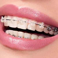 دستیار مسلط به ارتودنسی
