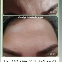 زیبایی و سلامتی پوست ومو|آرایشی، بهداشتی، درمانی|بابل, |دیوار