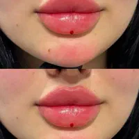 آف ژل وبوتاکس|خدمات آرایشگری و زیبایی|مسجد سلیمان, |دیوار