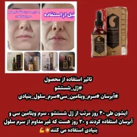 سرم جوان ساز