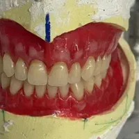 آموزش تخصصی دندانسازی، بلیچینگ