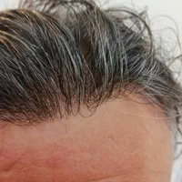 تخصصی ترین کلینیک پروتز مو در تهران (نقد و اقساط)|خدمات آرایشگری و زیبایی|تهران, صادقیه|دیوار