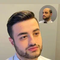 پروتز مو بابل