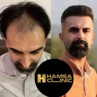 کلینیک فوق تخصصی کاشت مو،ابرو و ریش و زیبایی