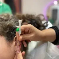 خدمات پرسینگ میکرودرمال چالگونه بوتاکس کل صورت
