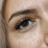 کاشت مژه هیدن