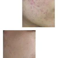 آموزش فیشال صفر تا ۱۰۰|خدمات آموزشی|تبریز, |دیوار