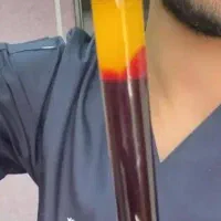 رشد سریع مو و پرپشت شدن مو