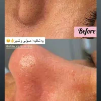 شفاف و درخشان