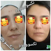 پک منافذ پوست|آرایشی، بهداشتی، درمانی|اهواز, باغ شیخ|دیوار
