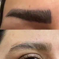 پاک کردن تتو جدیدترین دستگاهای روز دنیا