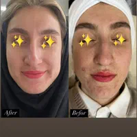 جشنواره فشیال تخصصی با ۵۰٪ تخفیف فقط برای ۵ نفر|خدمات آرایشگری و زیبایی|یزد, |دیوار