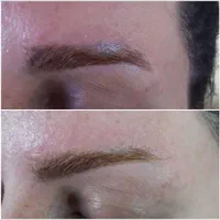 پاک کردن تتو صورت و بدن|خدمات آرایشگری و زیبایی|شاهین‌شهر, مخابرات (شهید بهشتی)|دیوار