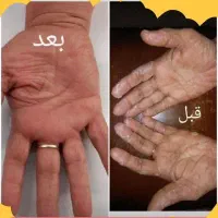 کسب درامد در منزل با طب سنتی ویژه بانوان با آموزش|استخدام درمانی، زیبایی، بهداشتی|کاشان, امیرکبیر|دیوار