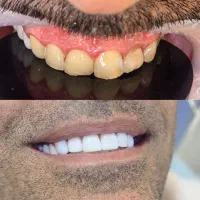 جشنواره دندانپزشکی اقساطی بدون پیش پرداخت