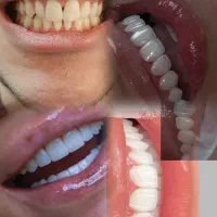 آموزش عملی و تخصصی دندانپزشکی