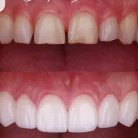 نیازمند استخدام دستیار دندانپزشکی