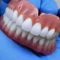 اقساط ویژه ایمپلنت دیجیتال،اوردنچر،دندان مصنوعی..|خدمات زیبایی و سلامت|تهران, مجیدیه|دیوار