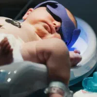 دستگاه زردی نوزاد