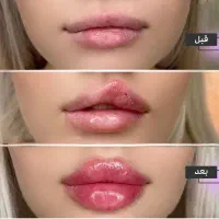 اگه دوست داری به لبت ژل بزنی بخون