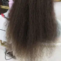 احیا مو ب روش تخصصی