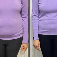 لاغری موضعی تضمینی همراه با تست