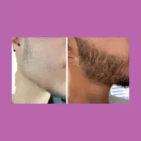 جای خالی ریشت رو اینجا پر کن