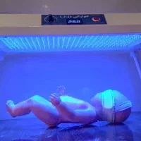 اجاره دستگاه فتوتراپی یا زردی نوزاد